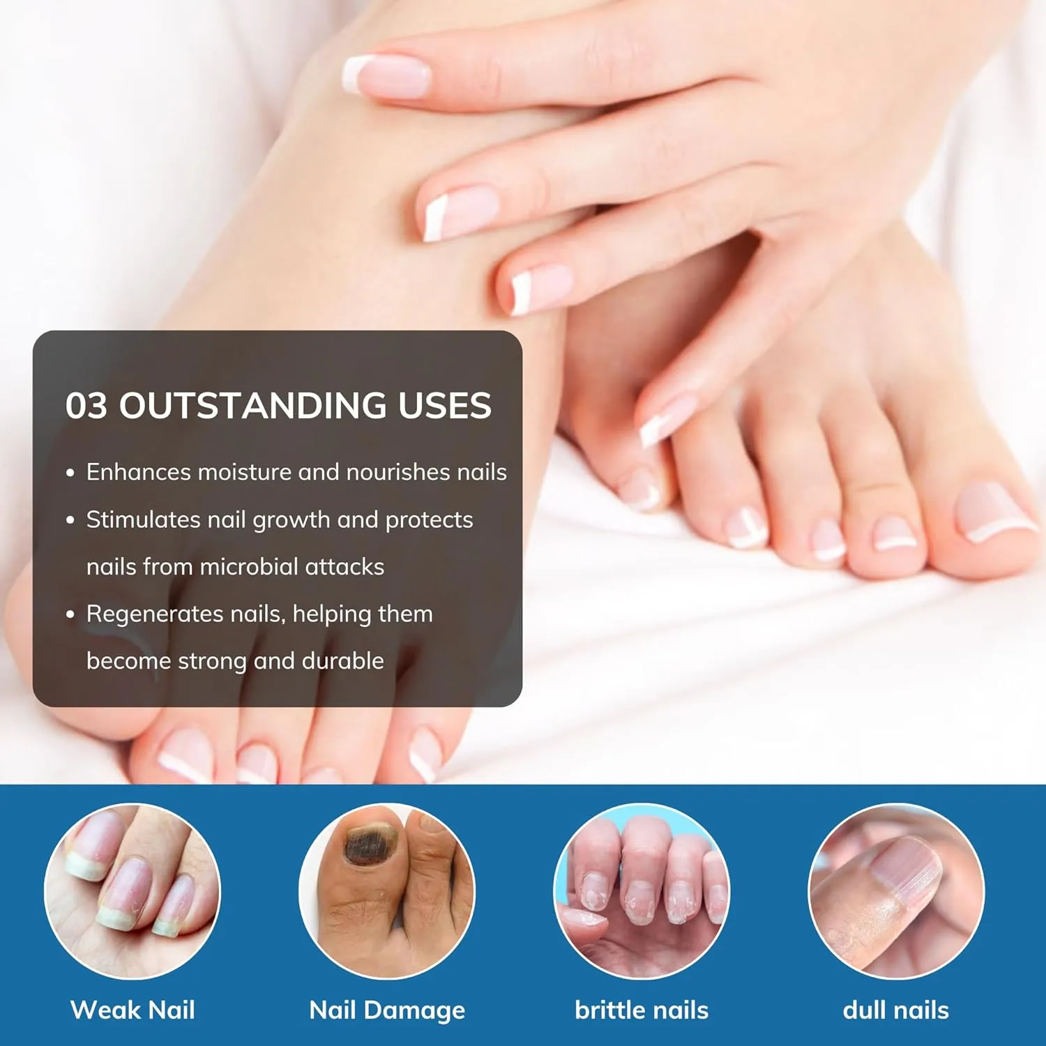 Abera Advanced Nail Repair Serum - Restorative Care for Brittle, Cracked & Discolored Nails - Supports Healthy Nails (Blue)