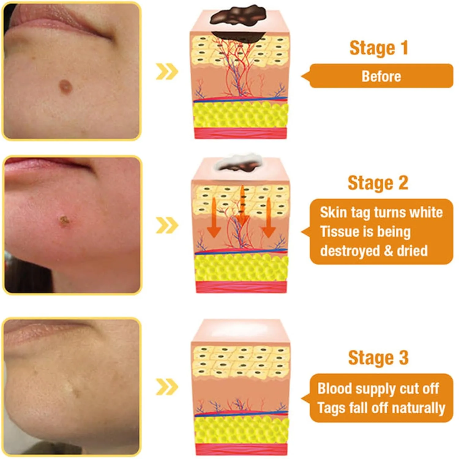All Body Skin Treatment Cream, Bee Venom Skin Treatment Cream, Bee Venom All-in-One Cream, for All Skin Types (2 Bottle)