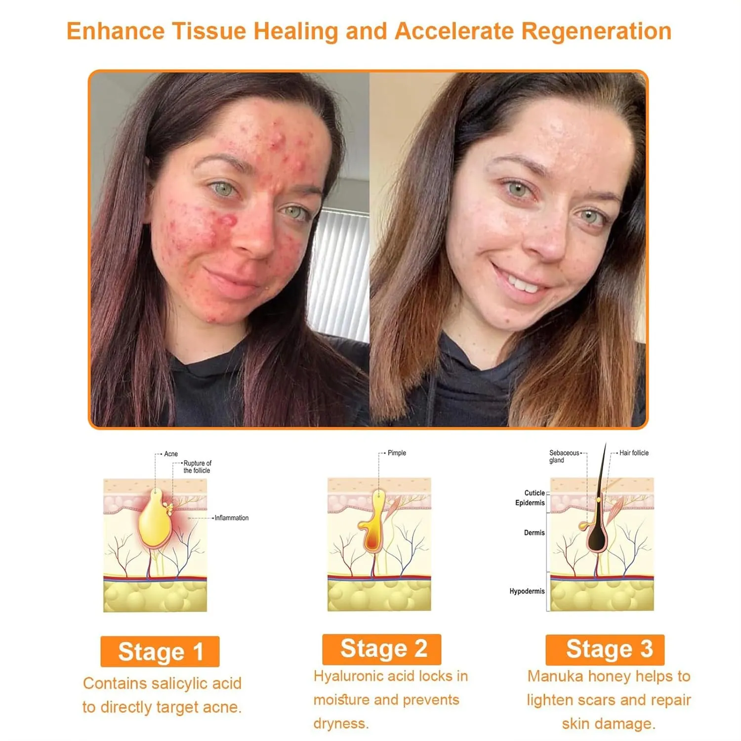 All Body Skin Treatment Cream, Bee Venom Skin Treatment Cream, Bee Venom All-in-One Cream, for All Skin Types (2 Bottle)