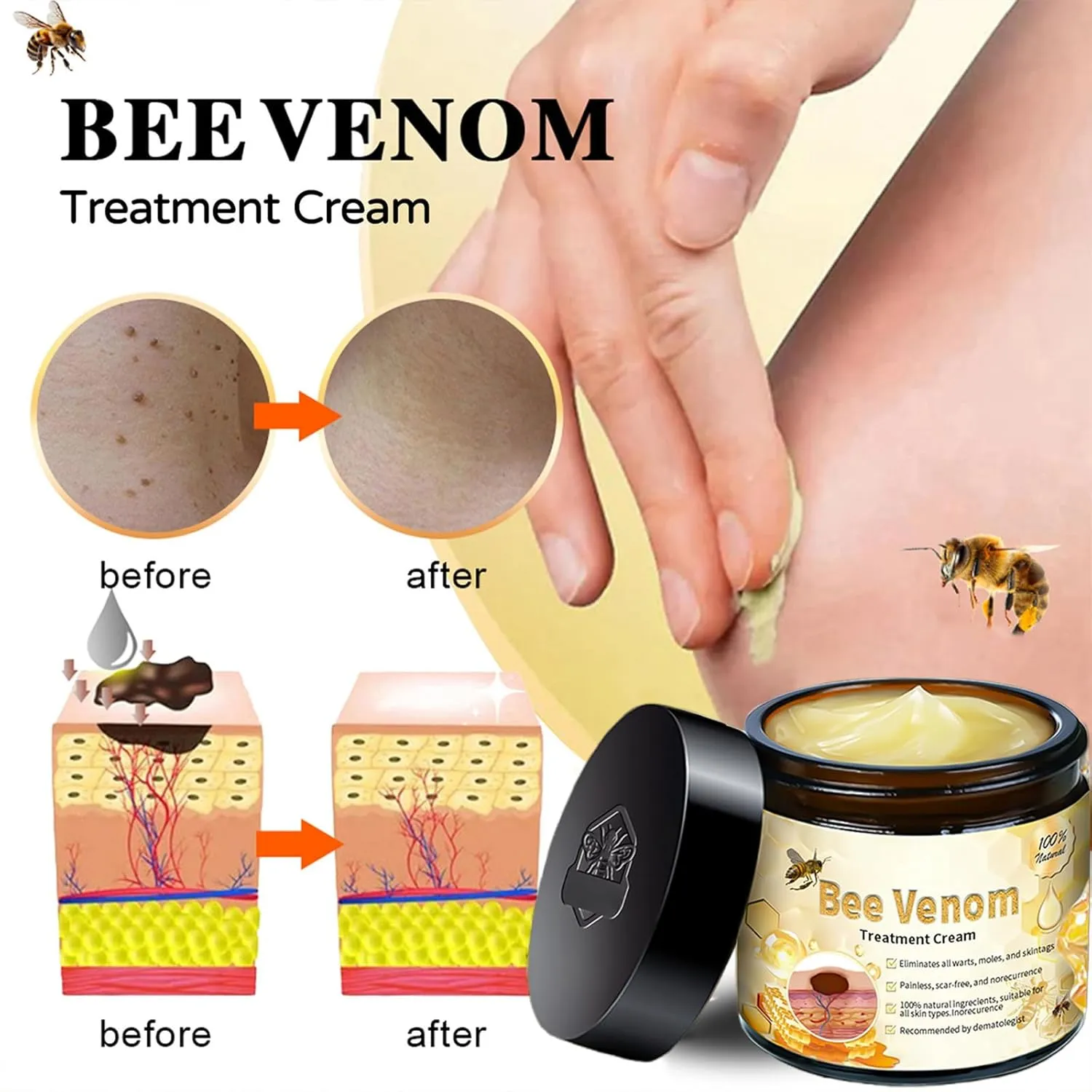 Bee Venom Skin Treatment Cream, Professional Bee Venom Cream, for All Skin Types (4 Bottle)