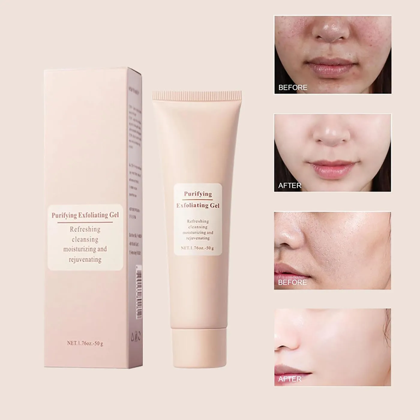 Dpoiex Purifying Exfoliating Gel, Dpoiex Exfoliating Gel, Moisturizing Deep Cleansing Face (2PCS, OEN SIZE)