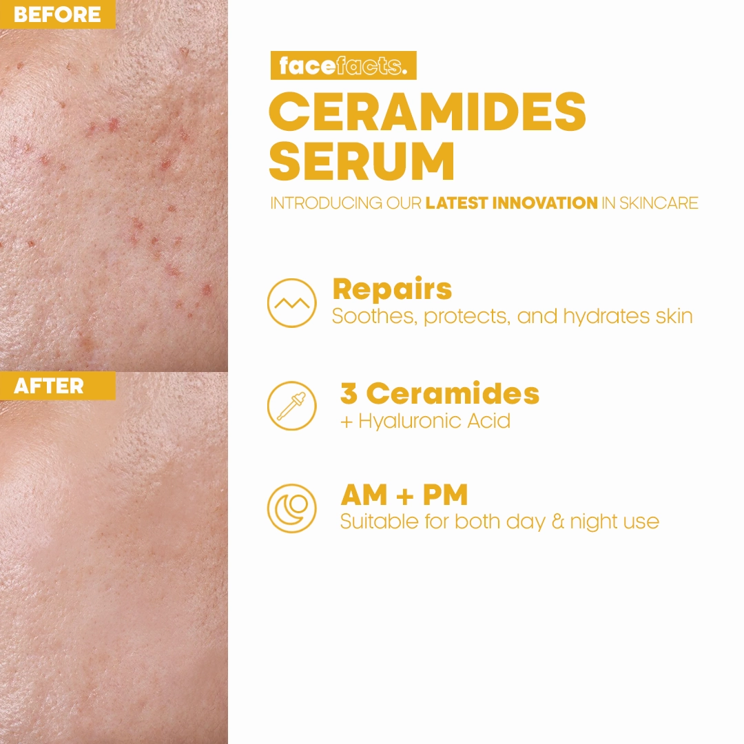 Face Facts Ceramide Facial Serum 30ml