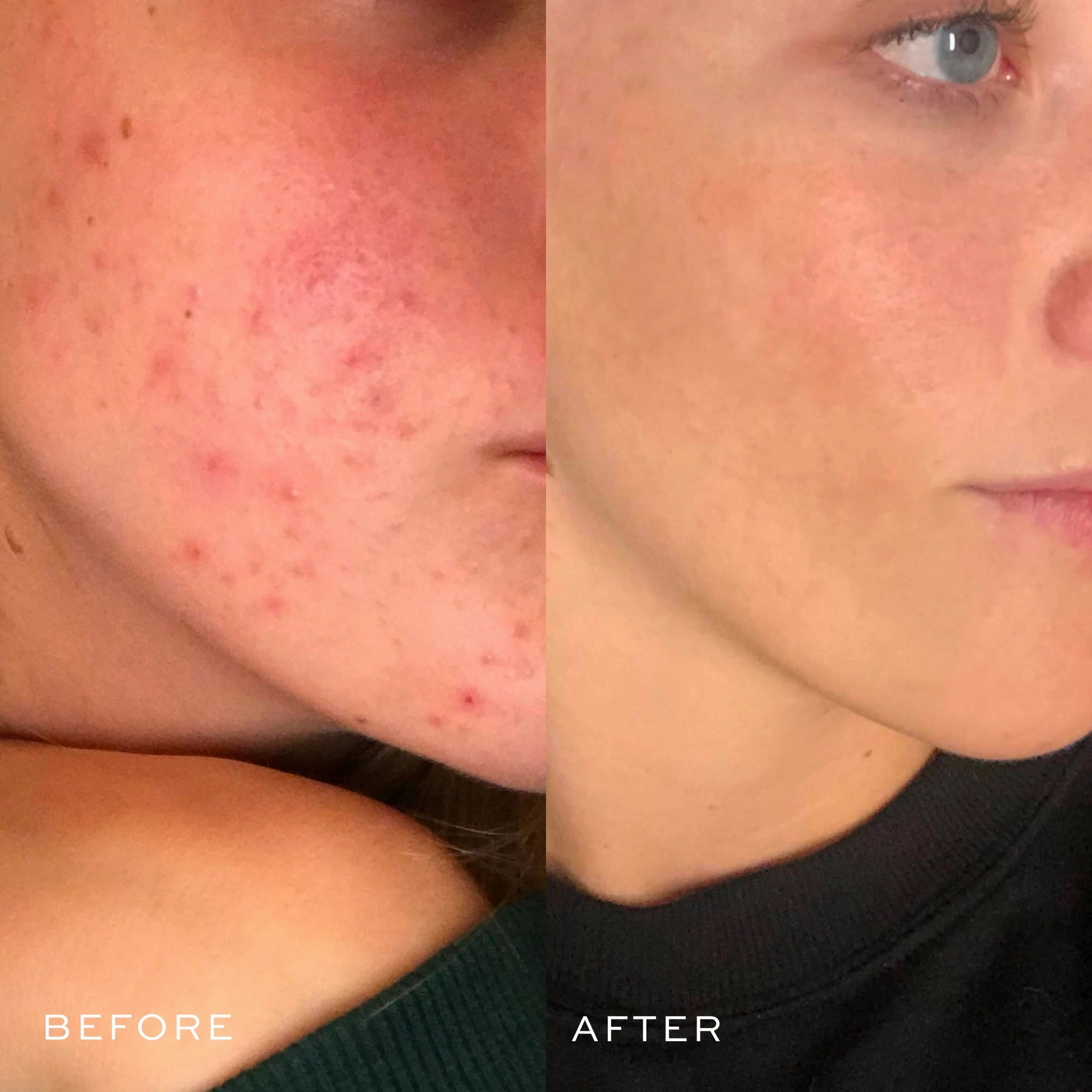 Gentle Jelly Cleanser