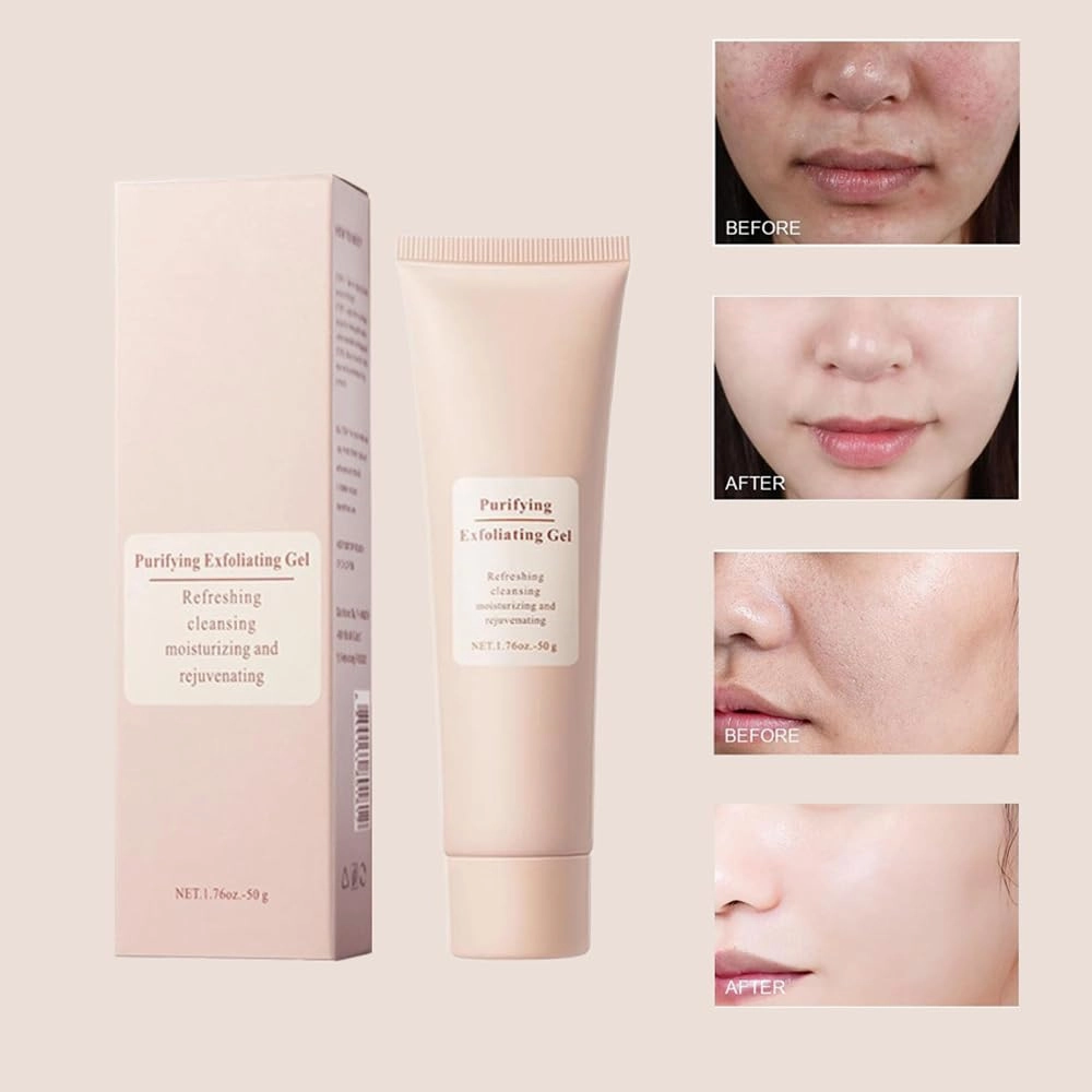 Grantadmit Exfoliating Gel, Gentle Purifying Exfoliating Gel Dead Skin, Deep Cleansing Face and Body, Unclogs Pores (2)