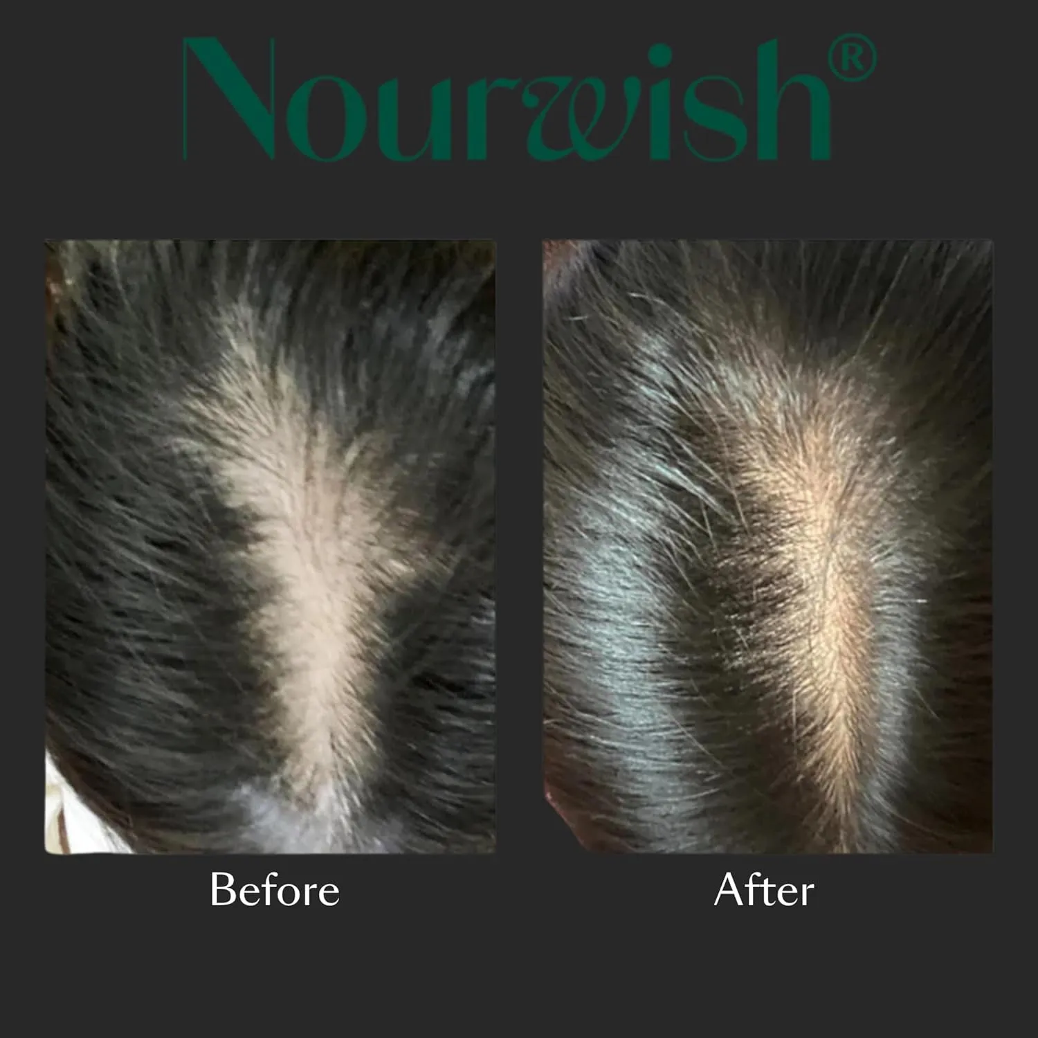 Hair Serum | Asian Haircare Hydrates & Supports Thicker & Stronger Hair | Rosemary, Niacinamide, Peppermint Oil | (Korean, Japanese) Hair Support (59ml)