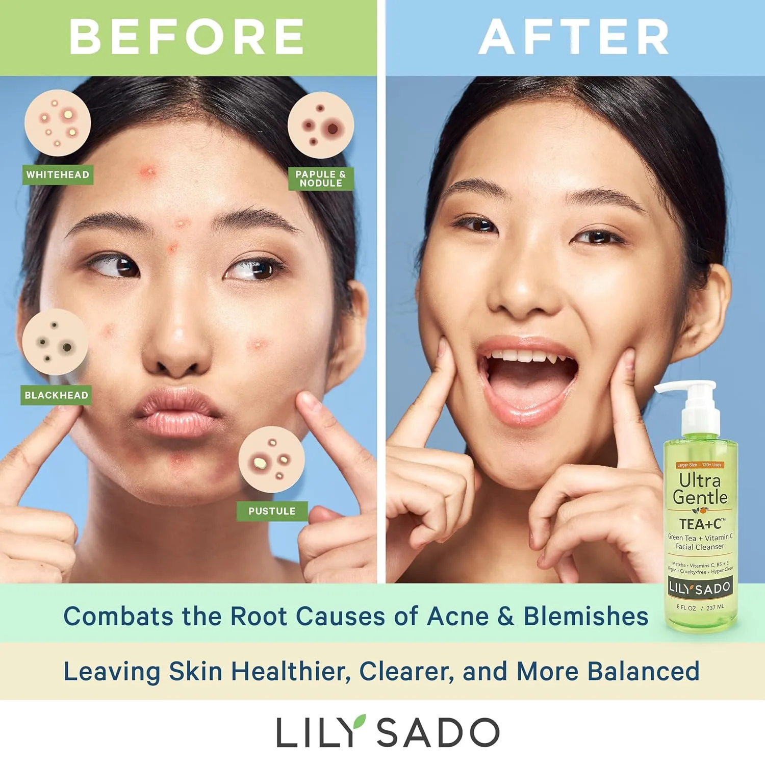 LILY SADO TEA C™ Green Tea & Vitamin C Face Cleanser – Natural Vegan Antioxidant Daily Face Wash with Aloe, Rosehip, Meadowfoam - Gentle Deep Cleansing for Acne, Blackheads, Blemishes. 8 oz