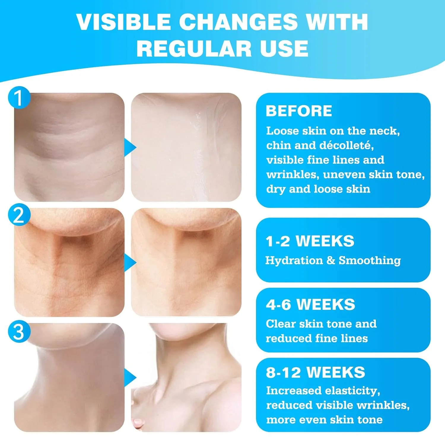 Neck Firming Cream, Tighten and Lift Neck Cream Tightening Lifting Sagging Skin, Tighten & Lift Neck Cream for Wrinkles Sagging Skin for an Even Skin Tone and Neck Lift (Blue, 1.7 FL OZ)