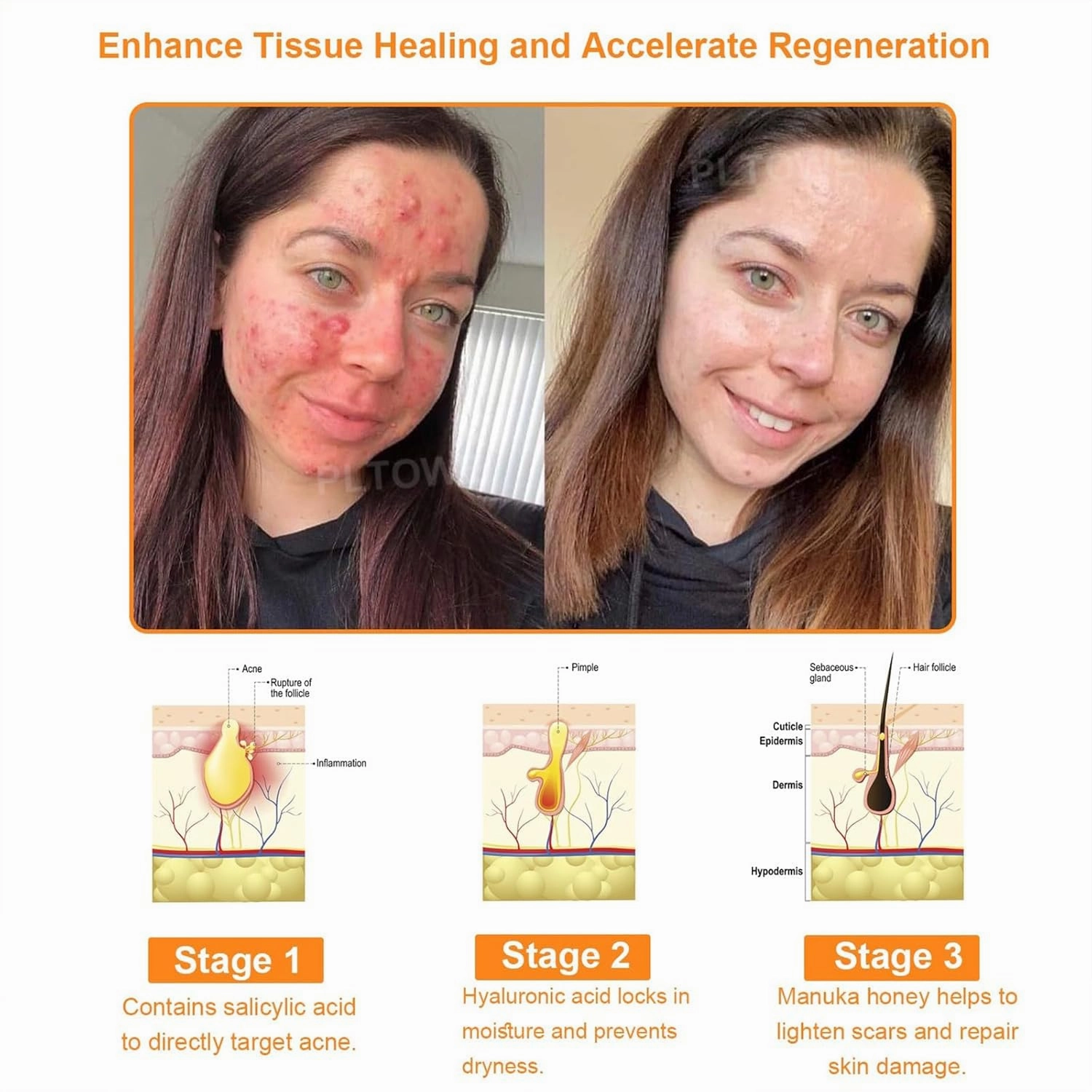 PLTOWE Powerful Al-Body Skin Treatment Cream, Professionelles Bee Venom Cream, PLTOWE Bee Venom Skin Treatment Cream, Repair skin barrier, for All Skin Types (2 Bottle)