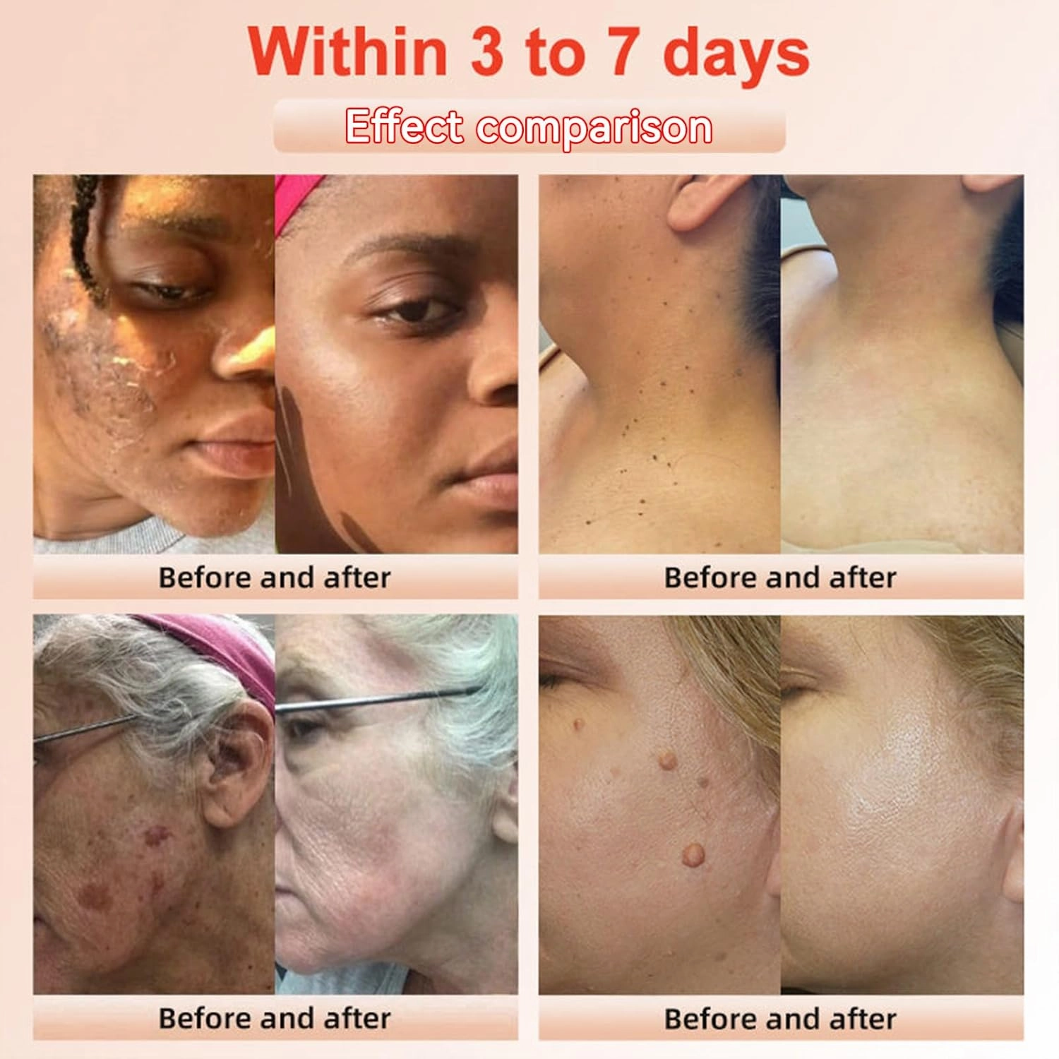 Purifying Exfoliating Gel, Exfoliating Scrub, Deep Cleansing Face and Body Scrub Gel, Moisturizing Cleanses Skin Give for Various Skin Types (3 Pack)