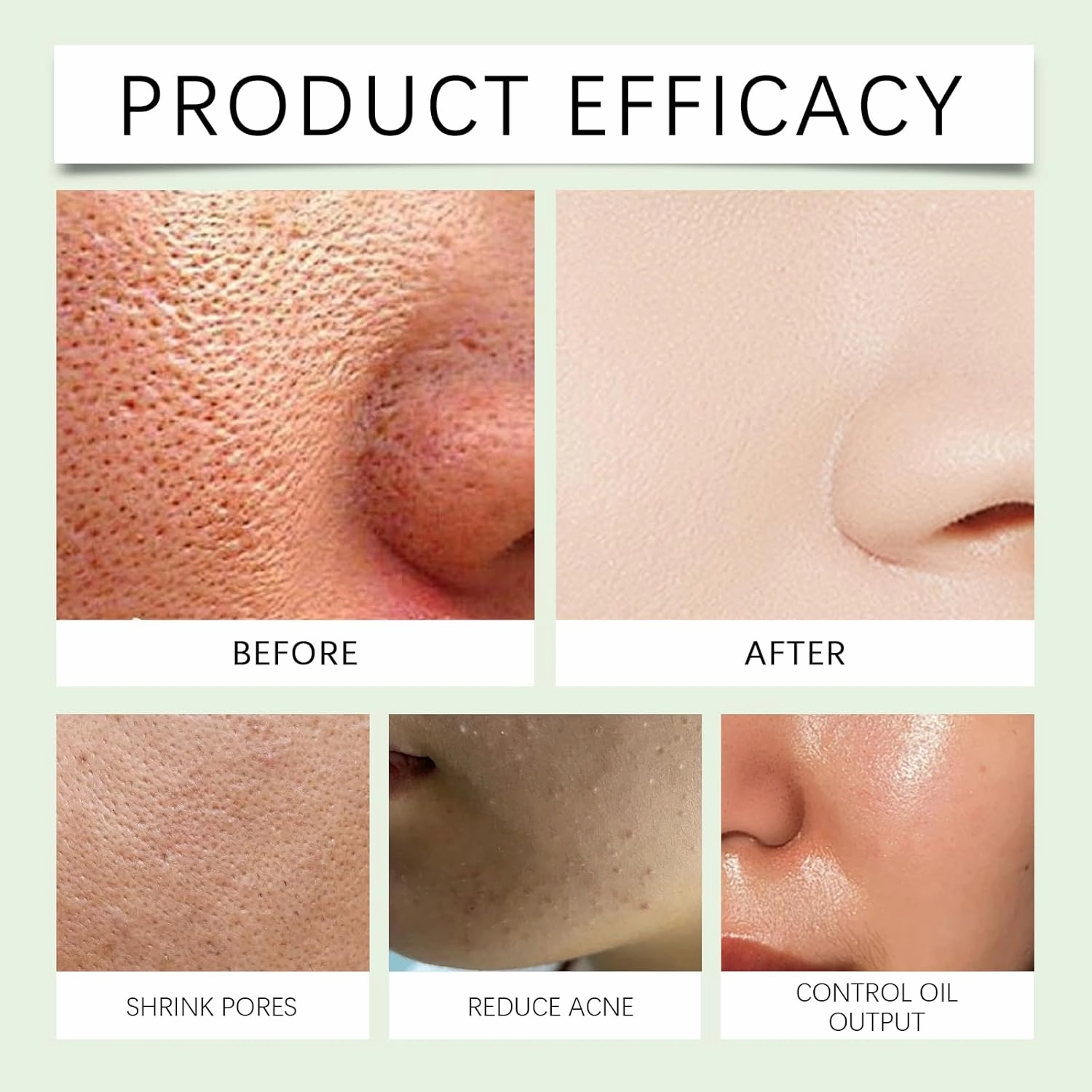 Purifying Exfoliating Gel, Facial Exfoliating Scrub Gel, Women Purifying Exfoliating Gel for Face Body Cleansing and Moisturizing (1PCS, medium)