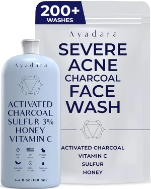 Severe Acne Charcoal Face Wash, 3.4 oz, Daily Cleanser with Sulfur and Honey, Face Cleanser for Acne, Deep Cleansing Charcoal Face Wash for Women and Men, 200 Uses