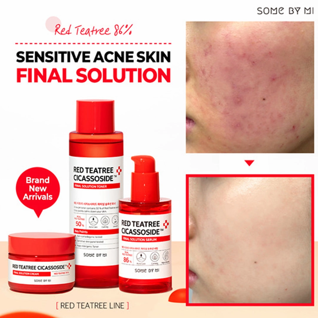 Some by Mi. Red Teatree Cicassoside Derma Solution Toner 150ml [Clearance]