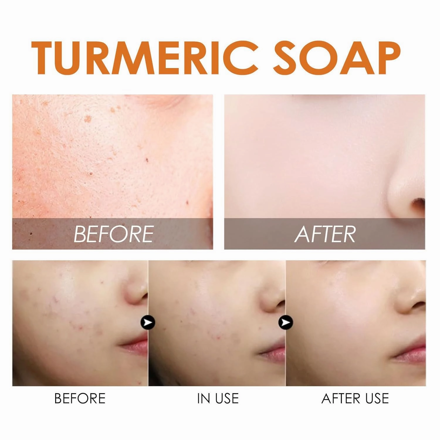 Turmeric Soap Bar-Turmeric Skin Brichtening Soap Face And Body, Moisturizing Soothing Gentle Cleanser Soap, Tumeric Deep Cleansing Face Wash (4pcs)
