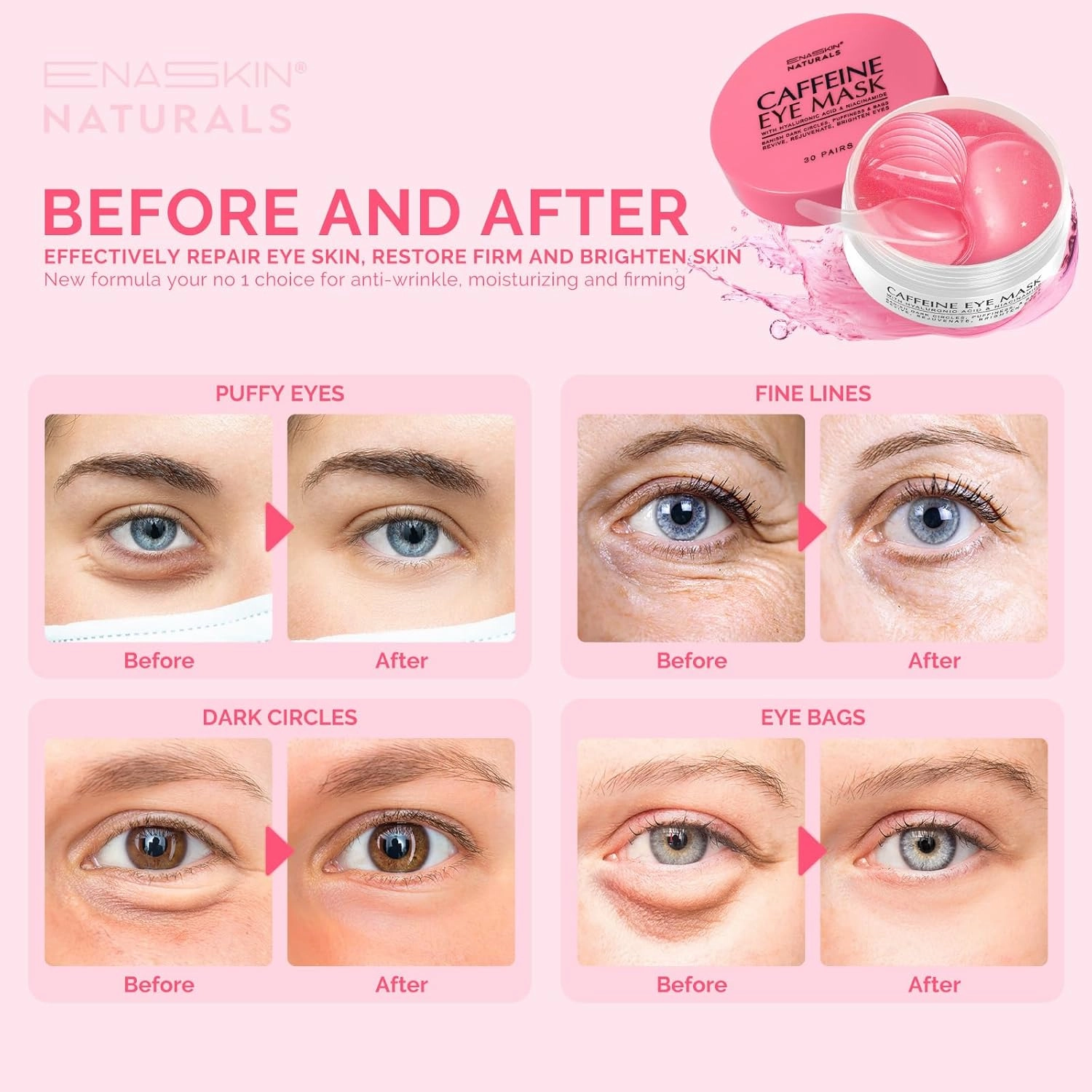 Under Eye Patches for Dark Circles: Caffeine Gel Masks for Puffiness Undereye Bags Wrinkles - Instant Brightening Moisturizing Skin Treatment Pads - Gift for Mom Traveler Night Worker, 30 Pairs (Pink)