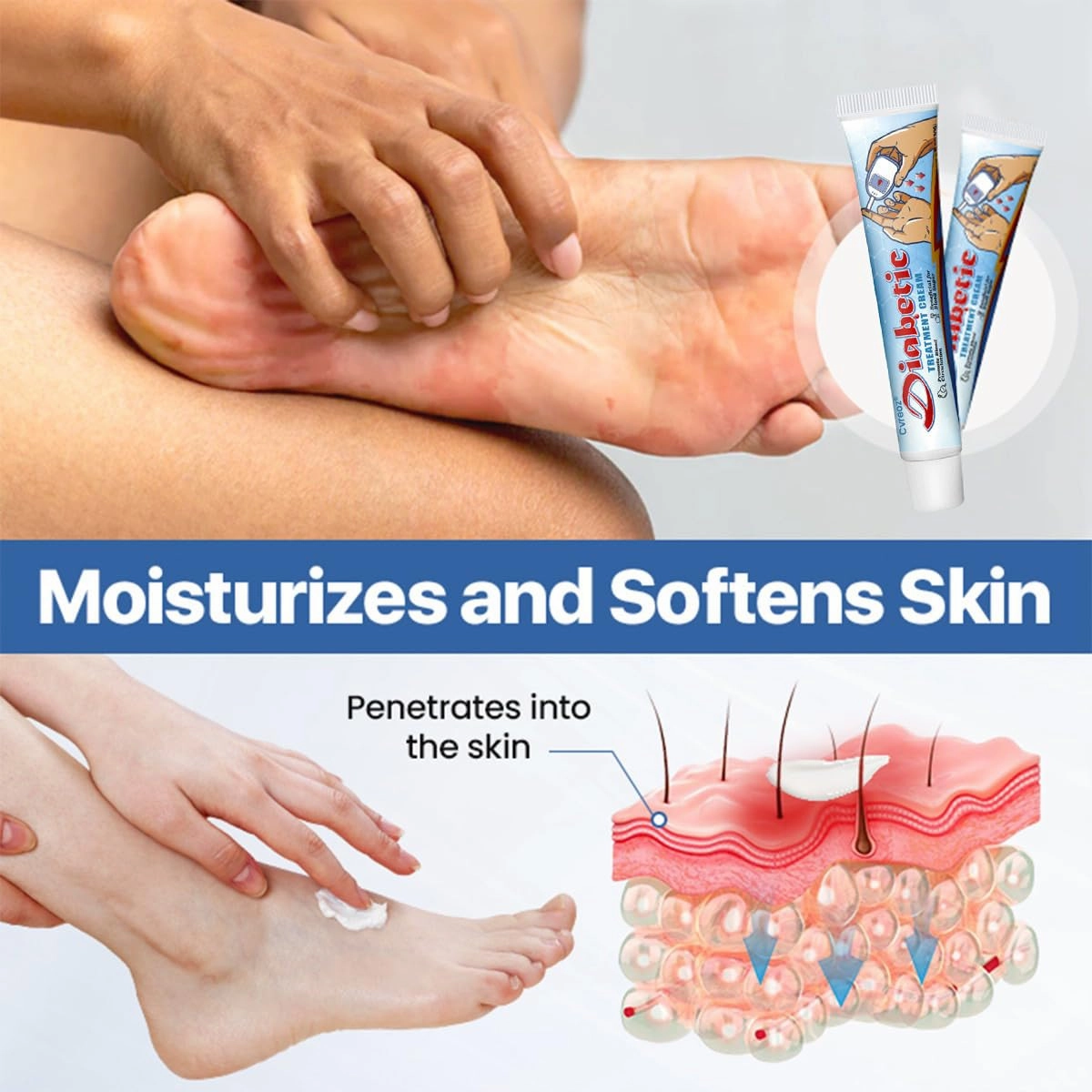 VitaGluco Diabetes Treatment Cream, Professional Diabetic Foot Cream, Diabetics Dry Skin Relief Moisturizing Cream, Natural Ingredients for Foot Care (1 Bottle)
