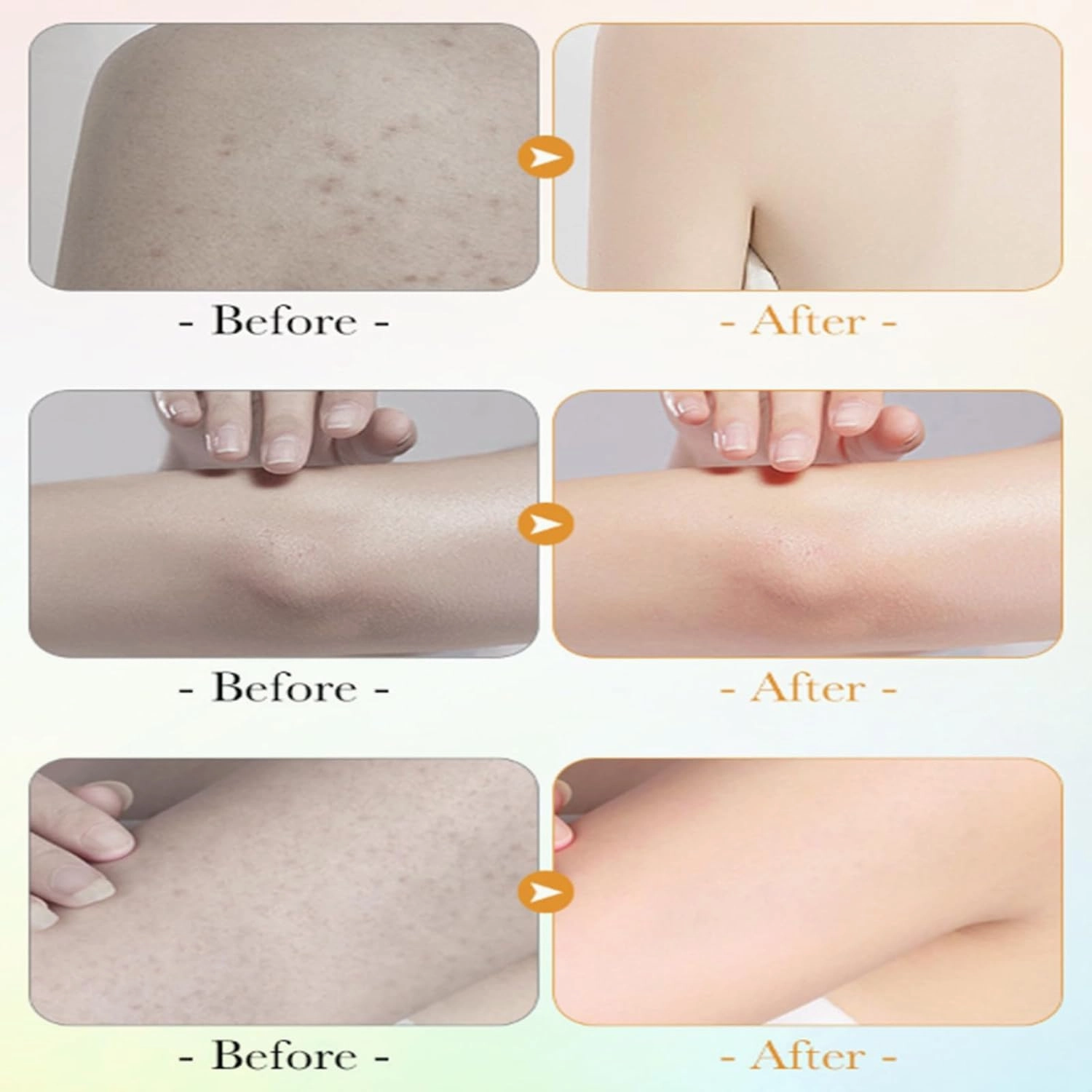 Vitamin C and Lemon Niacinamide Body Wash, Vitamin C Nourish Rejuvenation Body Wash, Evens Tone, All Skin Types, Gelimprove the Rough Skin (1, one size)
